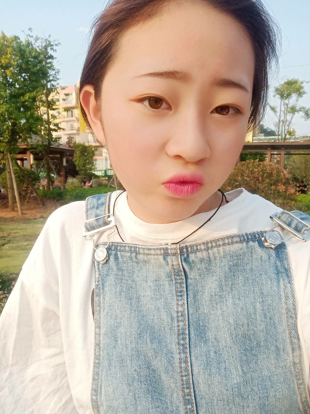 皮泡眼肿尼盖疮93-快手直播