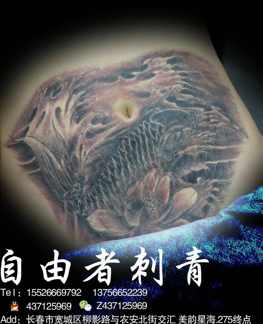 鱼,麻药控覆盖妊娠纹,有点范红,恢复后献图