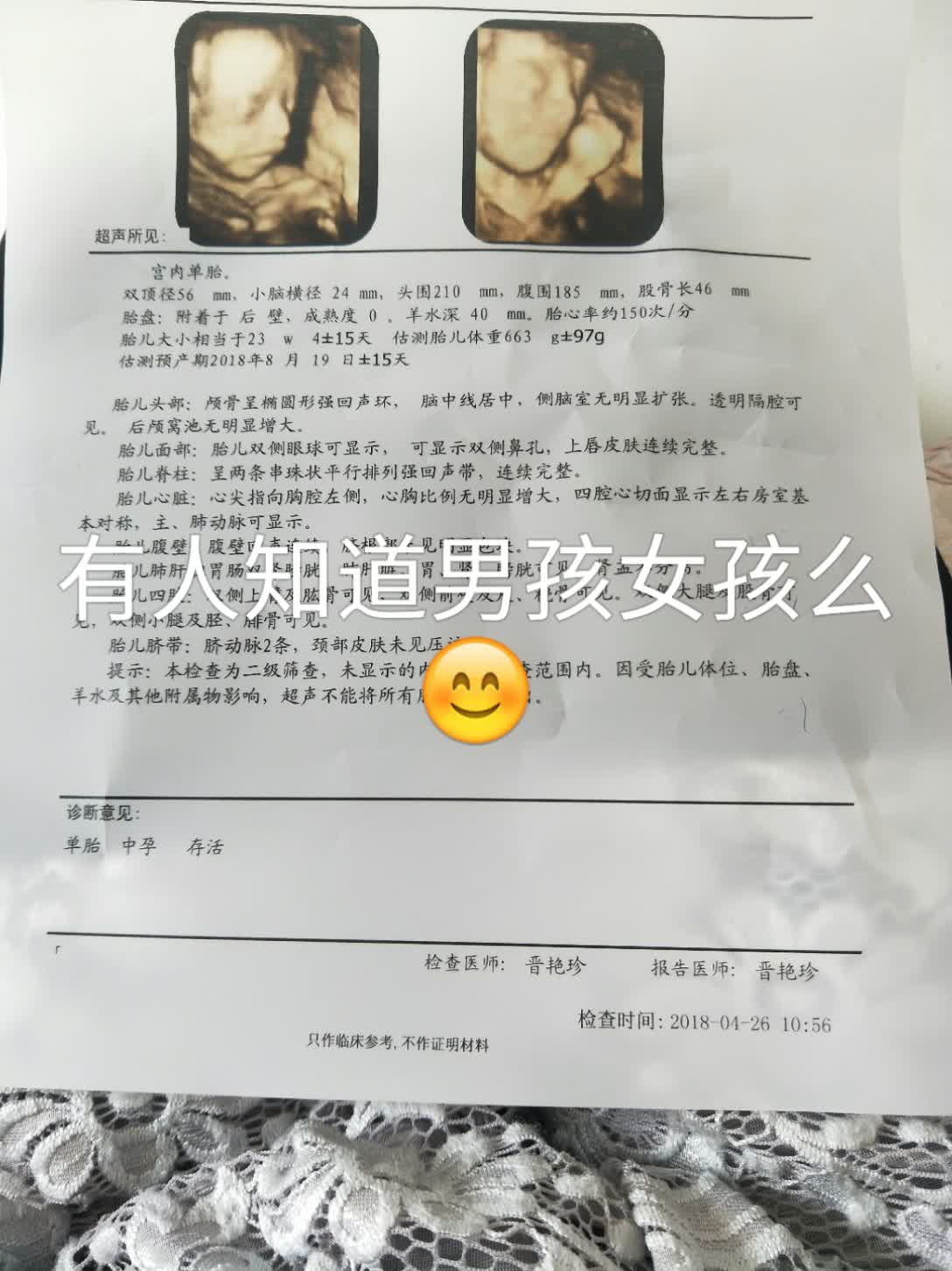 邱小妍7615的主页-快手直播