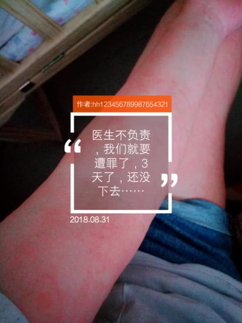 医生未做皮试,直接用头孢,导致过敏了,不知道要痒几天?