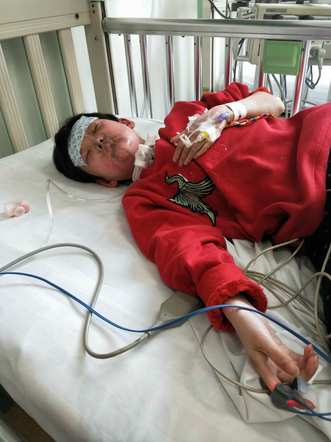 不知道在手术这一多小时孩子怎么针扎过来,受了多大的罪,只有孩子知道