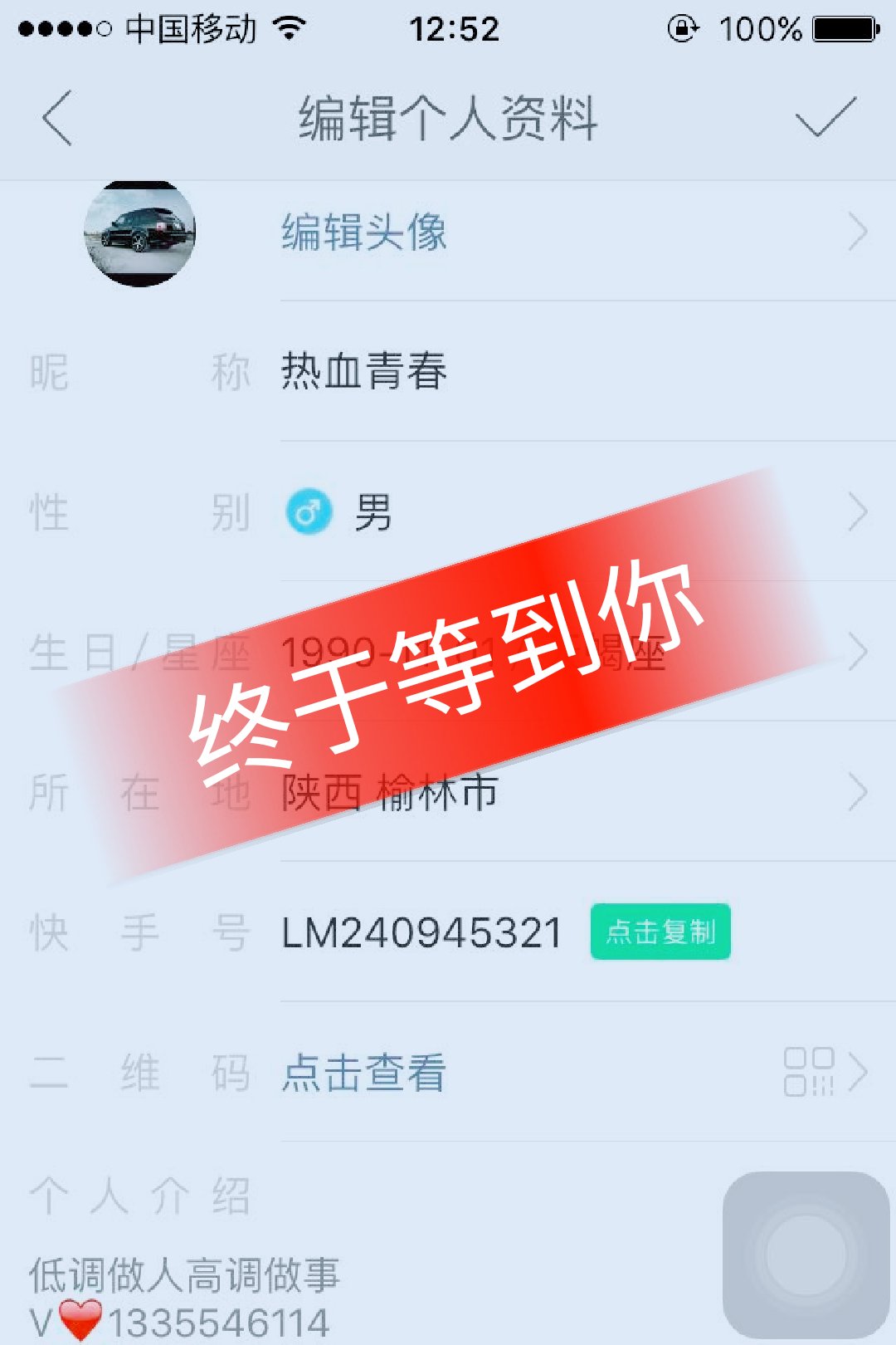 快手粉丝怎么一下没了怎么回事（快手粉丝变少了什么原因）