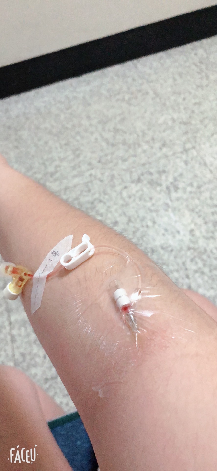 第一次埋针 187       赞                   评论              3月