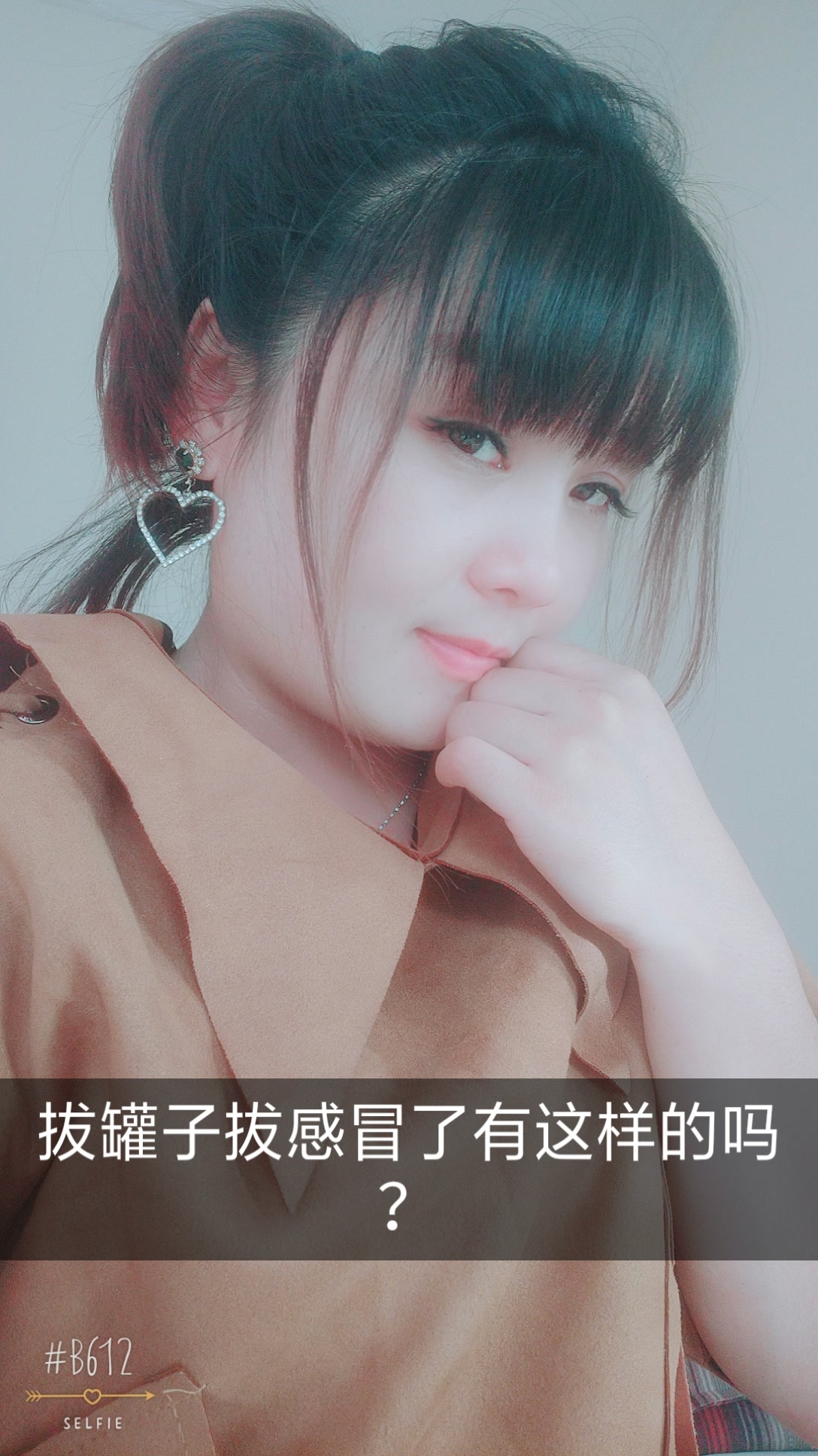 快手女士脑门拔罐图片